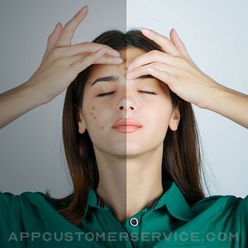 Pimple Remover - Acne Eraser Customer Service