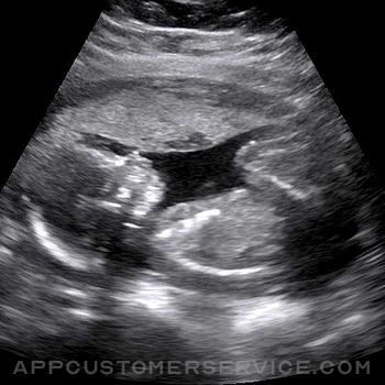 Baby Ultrasound 2015 Customer Service
